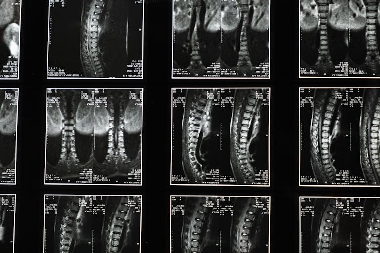 Comprehensive spinal x-ray images, ideal for medical studies and diagnostics.