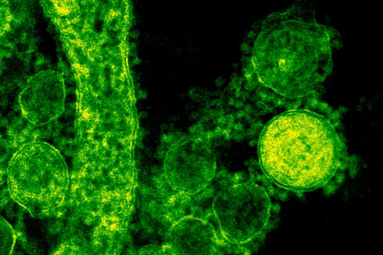 Green-tinted microscopic image of coronavirus particles illustrating viral structures.