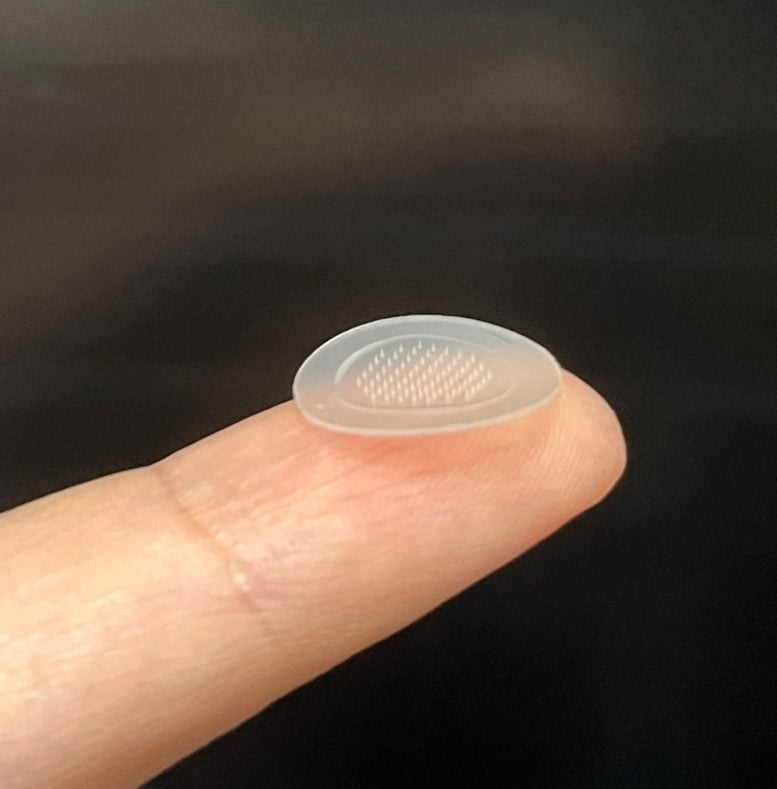 New Microarray Pimple Patch Clears Acne in Just 7 Days