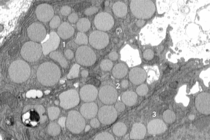 Cells Have a Startling Way of Healing — But It Comes With a Risk Cells Have a Startling Way of Healing — But It Comes With a Risk
