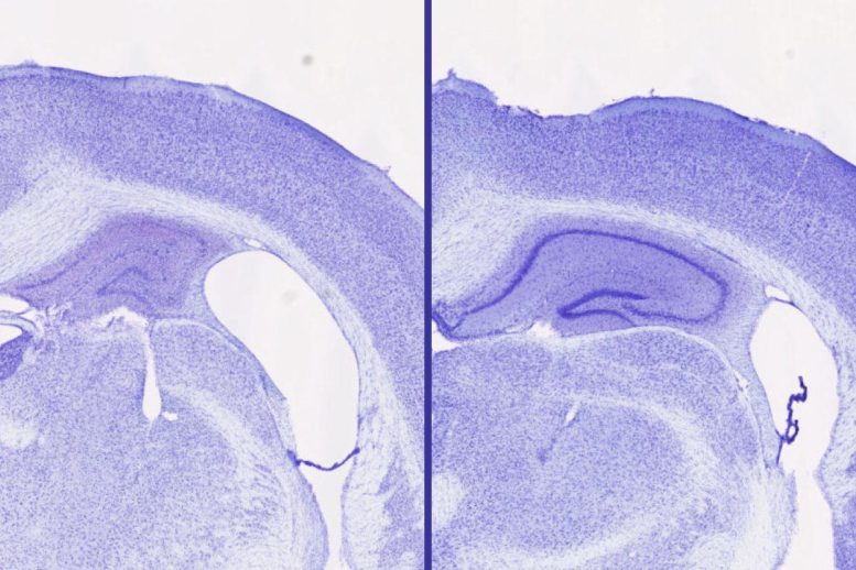 Could a Common Sleep Aid Help Protect the Brain From Alzheimer’s? Could a Common Sleep Aid Help Protect the Brain From Alzheimer’s?