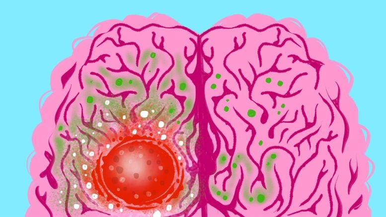 How a New Diet Slowed Aggressive Brain Tumors in Mice How a New Diet Slowed Aggressive Brain Tumors in Mice