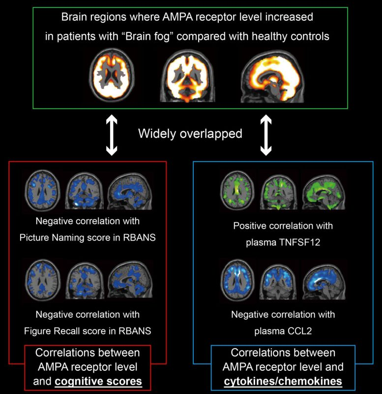Scientists Identify Biological Basis of Long COVID Brain Fog
