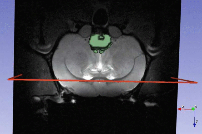 How Nanomedicine and AI Could Transform the Fight Against Neurodegenerative Diseases How Nanomedicine and AI Could Transform the Fight Against Neurodegenerative Diseases