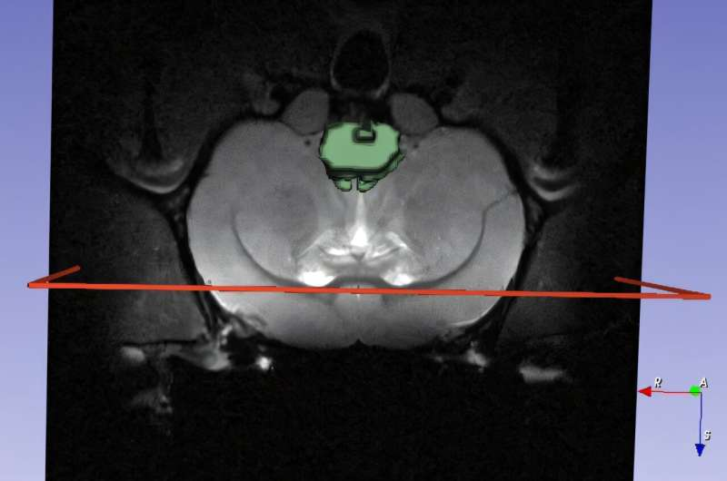 How Nanomedicine and AI Could Transform the Fight Against Neurodegenerative Diseases How Nanomedicine and AI Could Transform the Fight Against Neurodegenerative Diseases