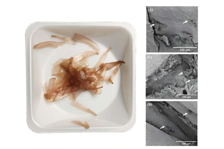 Seaweed Shows Promise as an Eco-Friendly Scaffold for Growing Human Tissues Seaweed Shows Promise as an Eco-Friendly Scaffold for Growing Human Tissues