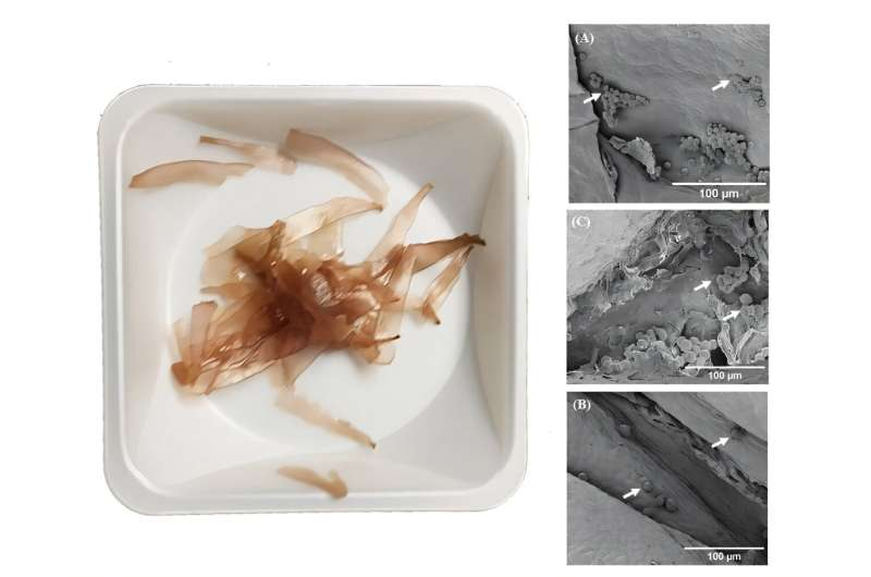 Seaweed Shows Promise as an Eco-Friendly Scaffold for Growing Human Tissues Seaweed Shows Promise as an Eco-Friendly Scaffold for Growing Human Tissues