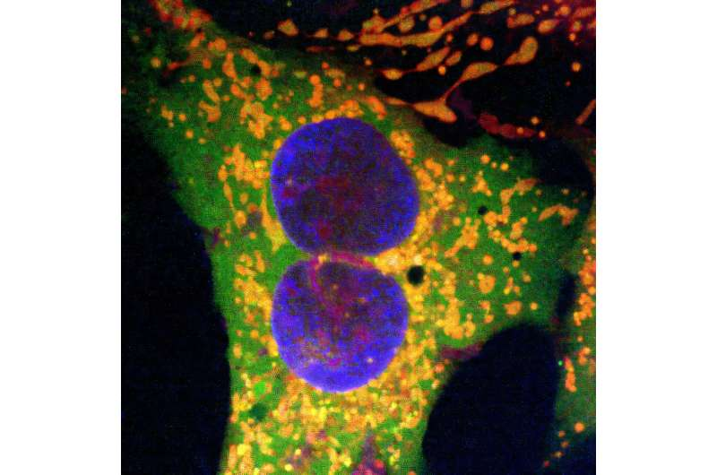 New Gene-Editing Method Uses Bacterial Retrons to Correct Large DNA Errors New Gene-Editing Method Uses Bacterial Retrons to Correct Large DNA Errors
