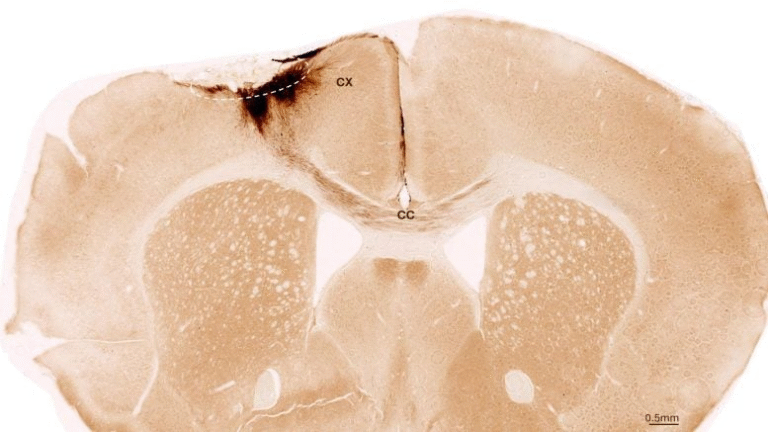 Stem Cells Reverse Stroke Damage in Mice – A Major Step Toward Brain Regeneration