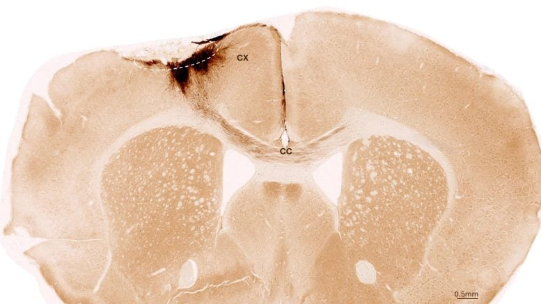 Stem Cells Reverse Stroke Damage in Mice – A Major Step Toward Brain Regeneration