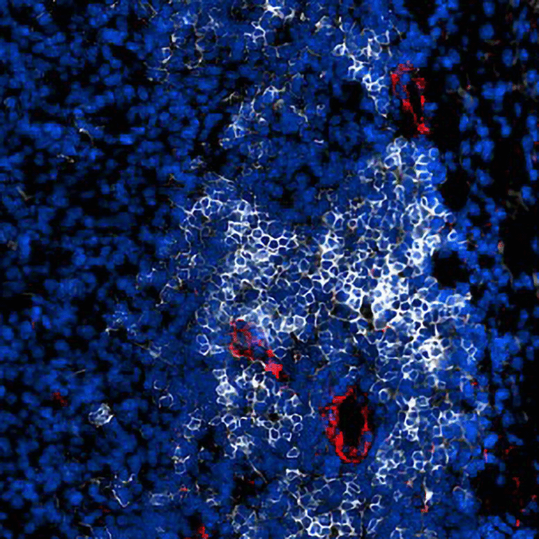 Scientists at Johns Hopkins Discover a Way to “Supercharge” the Immune System to Stop Cancer from Coming Back