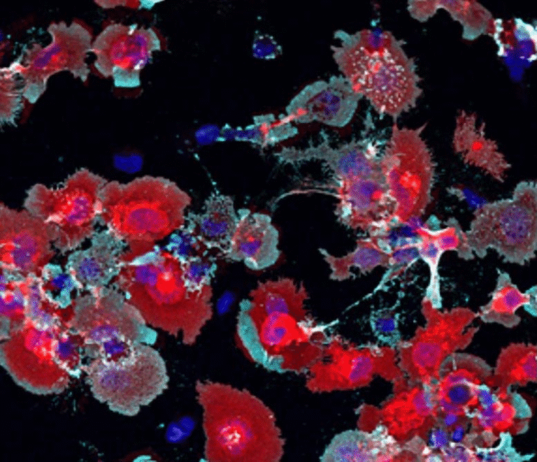 Rethinking Alzheimer’s: New Study Uncovers How Memory Loss May Really Happen