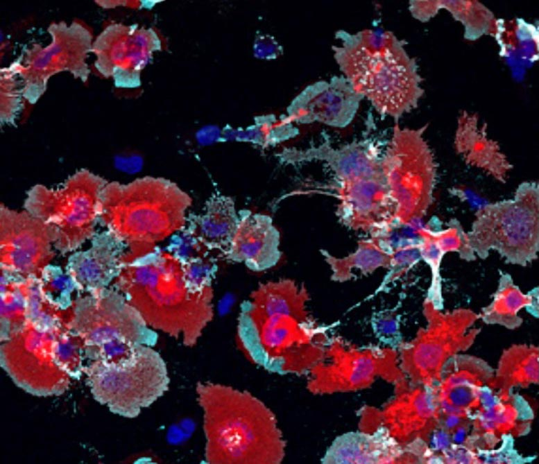 Rethinking Alzheimer’s: New Study Uncovers How Memory Loss May Really Happen