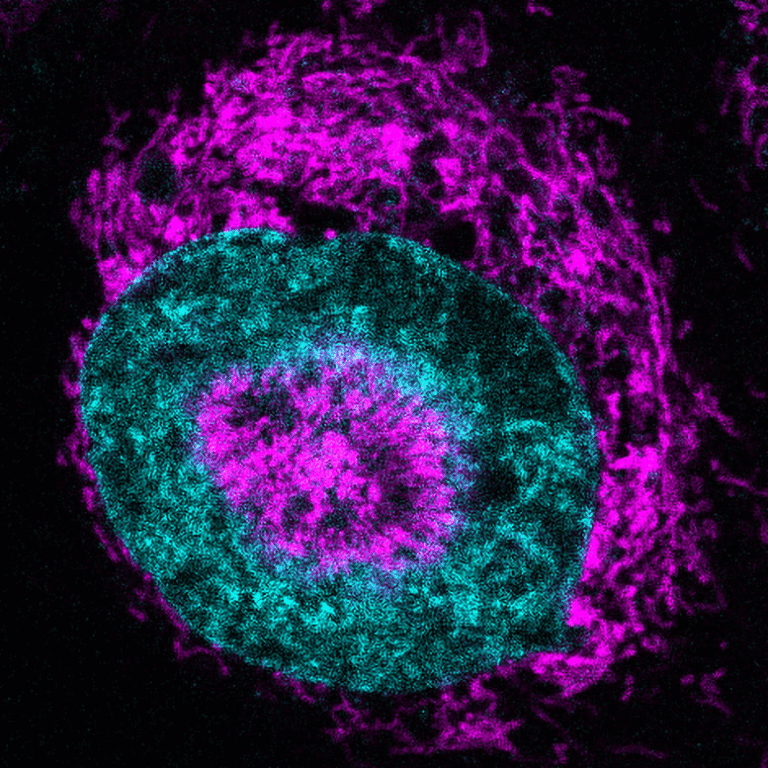 Scientists Uncover How Cancer Cells Power Up Under Pressure
