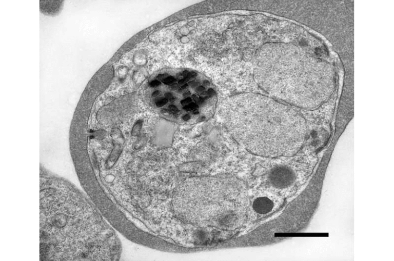 Scientists Discover Why Malaria Parasites Contain Wildly Spinning Iron Crystals