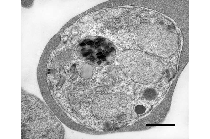 Scientists Discover Why Malaria Parasites Contain Wildly Spinning Iron Crystals