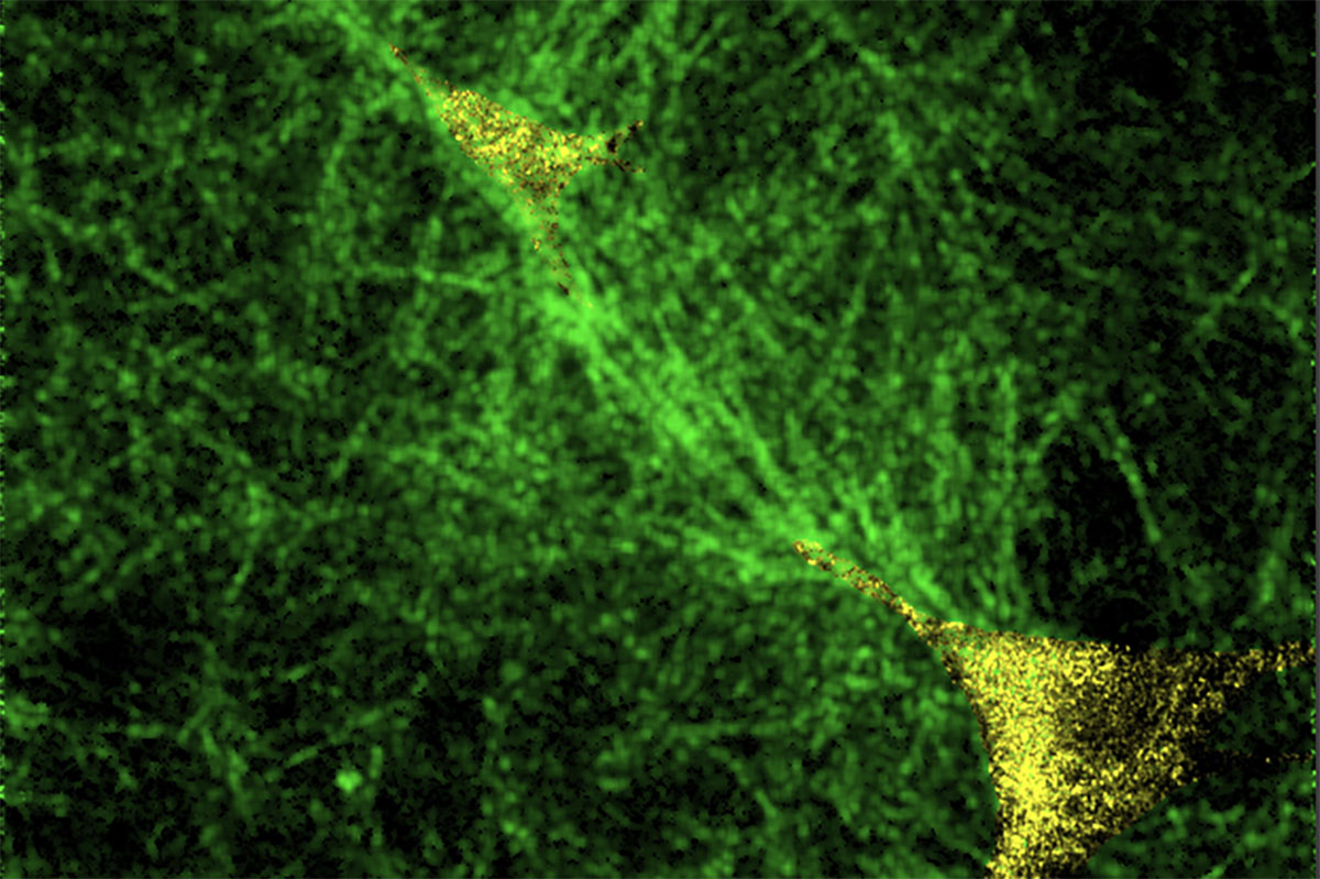 Scientists Discover How Cells Hit a Tipping Point and Turn Healthy Tissues into Diseased Ones