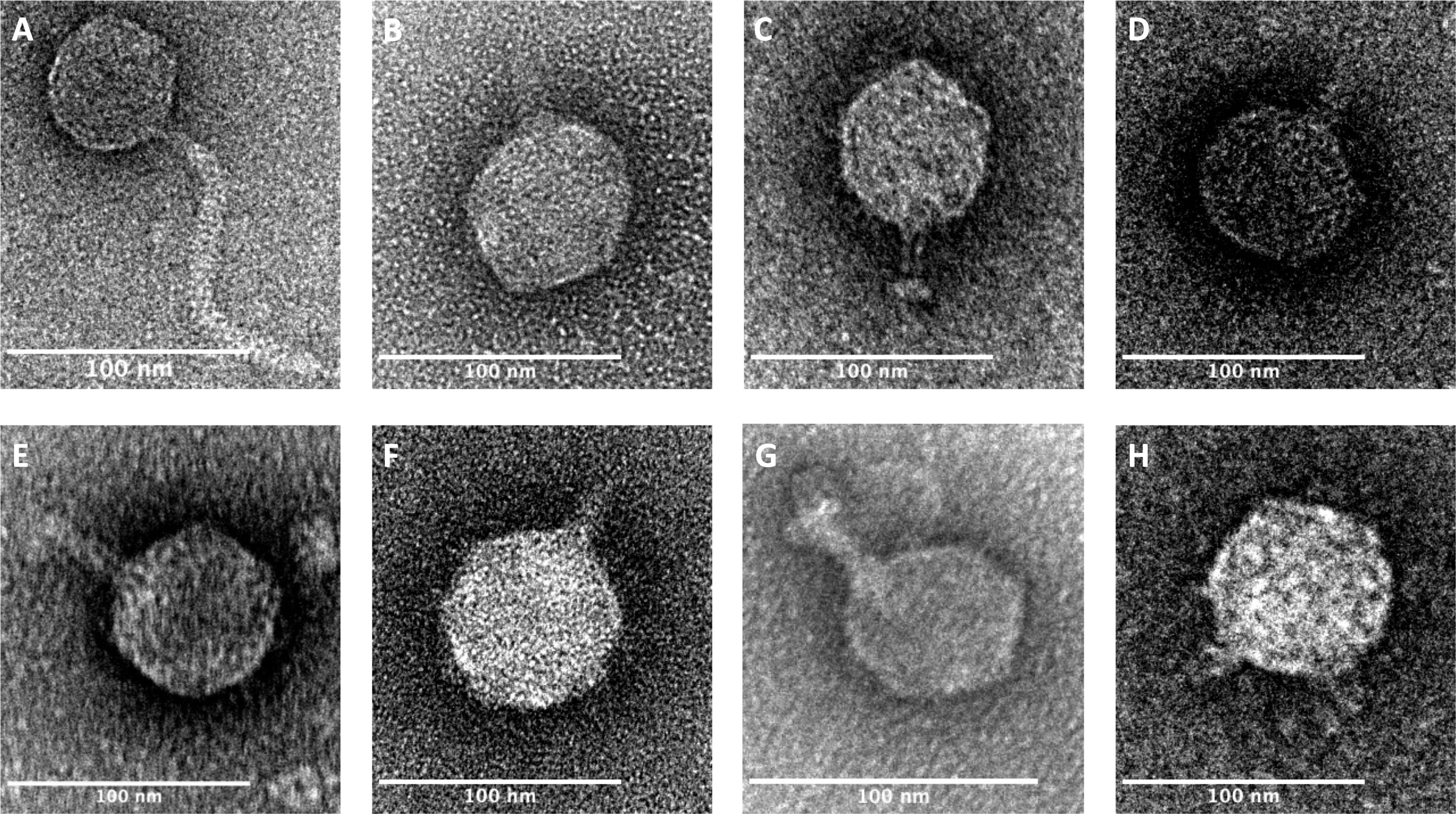 Genetically Modified Phages Deliver Bacterial Toxins to Defeat Multidrug-Resistant E. coli