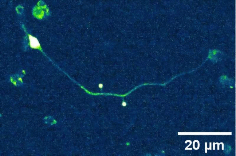 New Research Reveals How Membrane Obstacles Shape the Spread of Physical Forces in Neurons