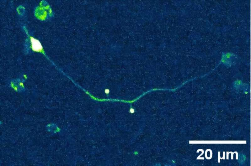 New Research Reveals How Membrane Obstacles Shape the Spread of Physical Forces in Neurons