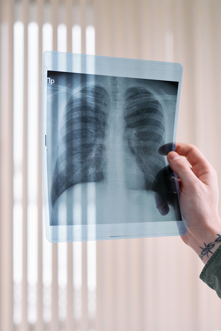A vertical shot of a doctor's hand holding a lung x-ray in a medical clinic, focusing on healthcare diagnosis.