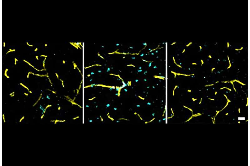 Hypertension Causes Early Brain Changes Long Before Blood Pressure Rises Hypertension Causes Early Brain Changes Long Before Blood Pressure Rises