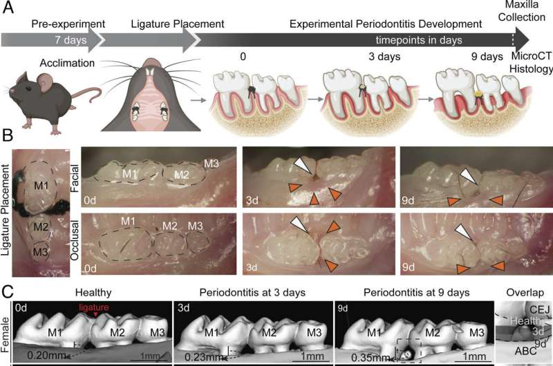 New Research Shows the Inflammasome Drives Male-Specific Bone Loss in Gum Disease