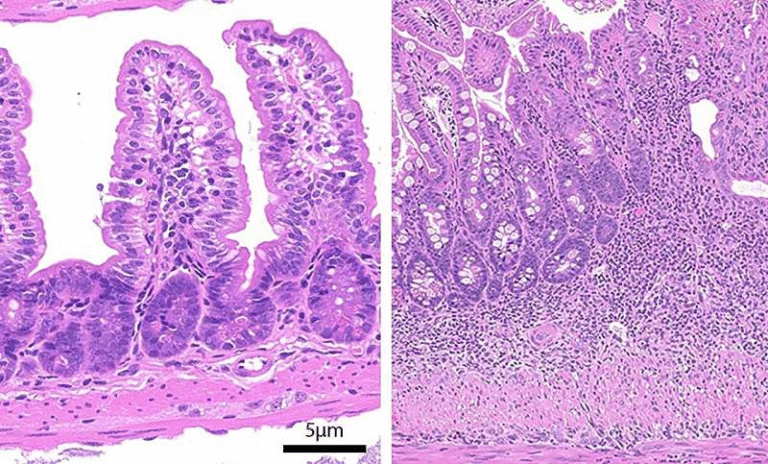 How ARPC5 Deficiency Disrupts Cell Structure, Weakens Immunity, and Unbalances the Gut Microbiome