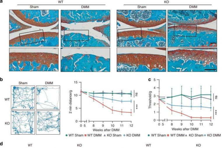 A Newly Identified Enzyme Could Open the Door to Treating Degenerative Joint Diseases