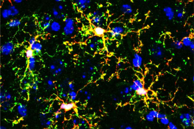Researchers Identify Two Types of Brain Immune Cells That Can Drive or Prevent Anxiety in Mice
