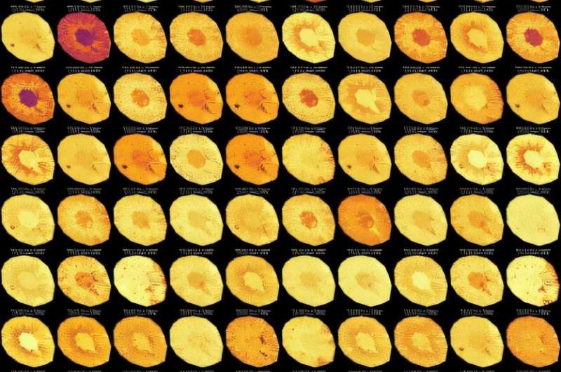 New Experimental Drug Shows Strong Protection Against Acute Kidney Injury in Mice by Targeting Ceramides