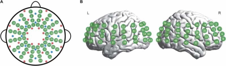 How Early Hearing Loss Disrupts Infant Brain Development and Why Fast Intervention Matters