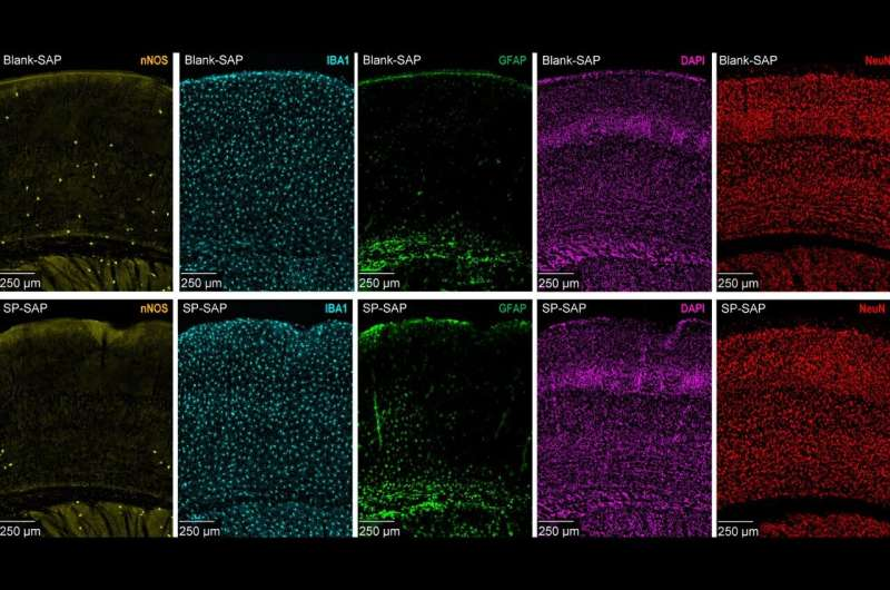 Stress May Disrupt Brain Blood Flow by Damaging Rare Neurons, New Research Finds Stress May Disrupt Brain Blood Flow by Damaging Rare Neurons, New Research Finds
