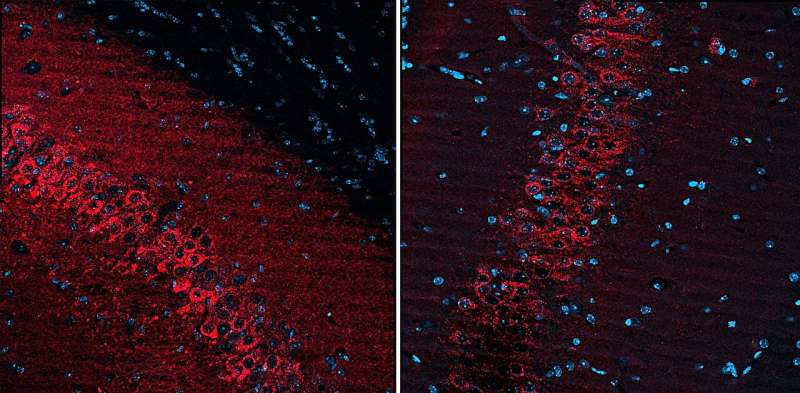 Nonsurgical Gene-Guided Ultrasound Treatment Shows New Promise for Targeted Seizure Control