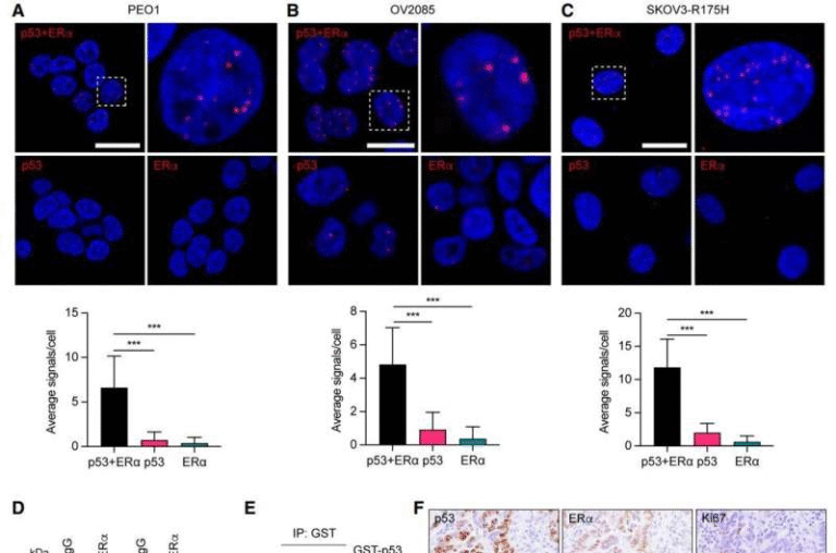 Why Anti-Estrogen Therapy Often Fails in Ovarian Cancer and How Scientists Are Finding a Way to Fix It