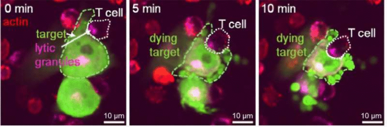 Engineered Immune Cells Show Powerful Ability to Destroy Glioblastoma in Preclinical Models