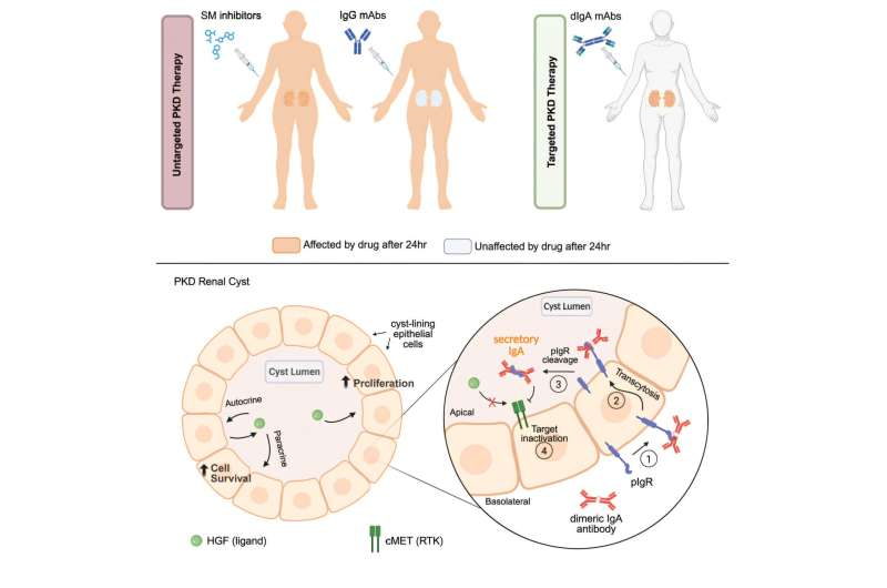 A Promising New Antibody Approach Shows Potential to Stop Polycystic Kidney Disease at Its Source