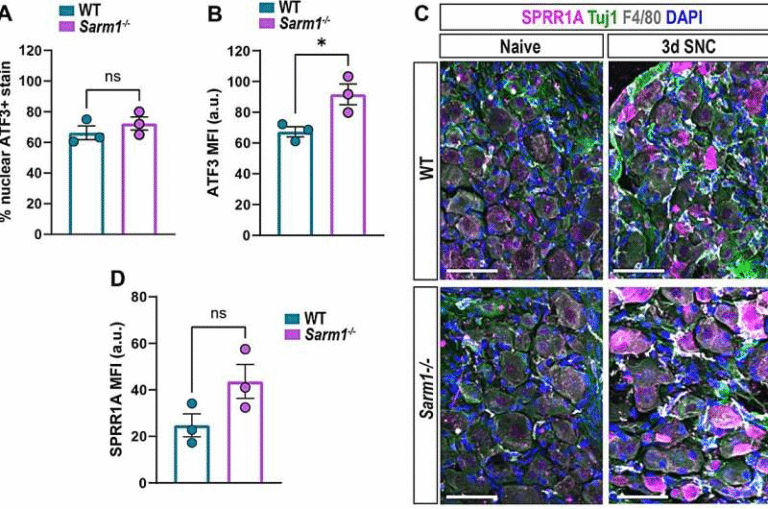 New Study Reveals How the Nerve-Repair Protein SARM1 Plays a Dual and Unexpected Role in Both Damage and Healing
