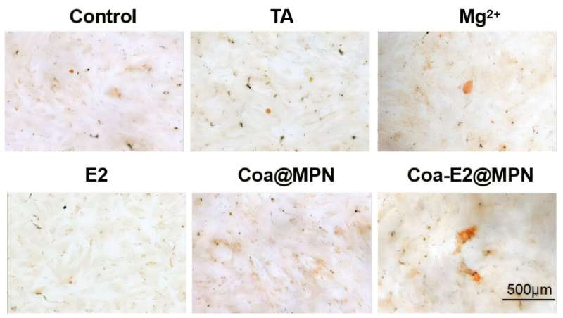 Bone-Targeted Estrogen Delivery Shows Promise for Reversing Postmenopausal Osteoporosis Without Uterine Side Effects Bone-Targeted Estrogen Delivery Shows Promise for Reversing Postmenopausal Osteoporosis Without Uterine Side Effects