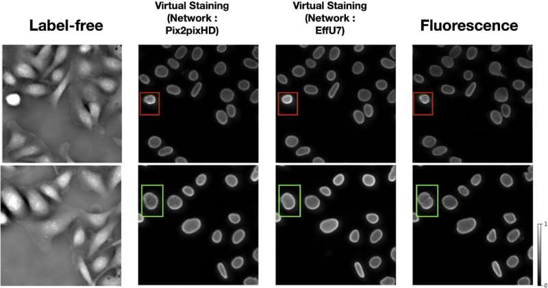 Researchers Warn That AI Virtual Staining Can Sometimes Reduce Accuracy in Medical Image Analysis