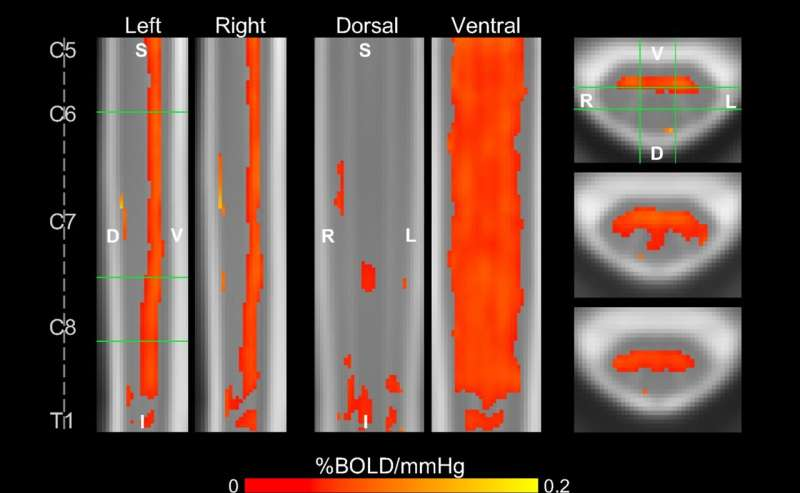 New MRI Method Maps Spinal Cord Blood Flow and Could Transform Injury Treatment