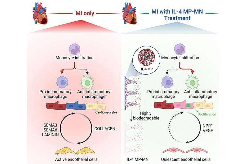 Biodegradable Microneedle Patch Shows Powerful Potential for Healing the Heart After a Heart Attack