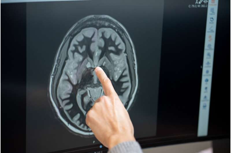 Tirzepatide May Quiet Food Noise in the Brain but Only for a Limited Time