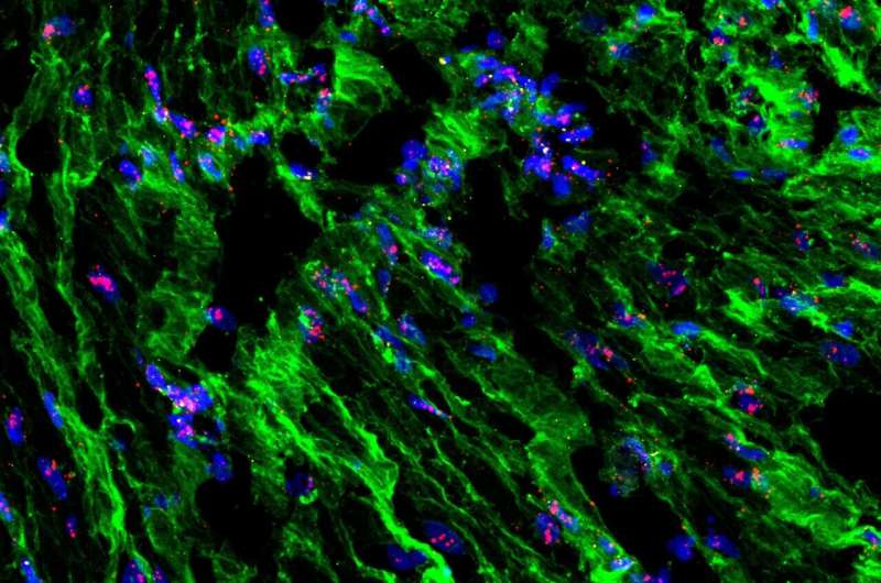How New Research Reveals the Role of Mechanical Force in Regulating Uterine Contractions During Childbirth How New Research Reveals the Role of Mechanical Force in Regulating Uterine Contractions During Childbirth