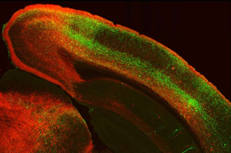 How the Prefrontal Cortex Reaches Back to Shape Vision and Movement Processing in the Brain How the Prefrontal Cortex Reaches Back to Shape Vision and Movement Processing in the Brain