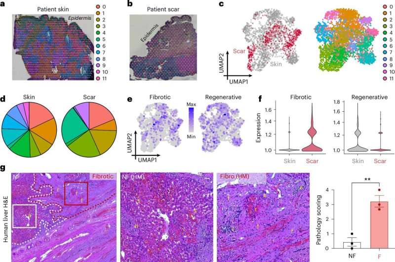 New Immune Cell Discovery Could Transform How We Prevent Scar Tissue Buildup in Wounds