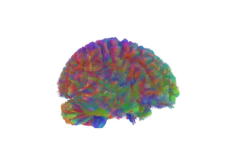 Scientists Identify Five Distinct Structural Eras in the Human Brain Across a Lifetime