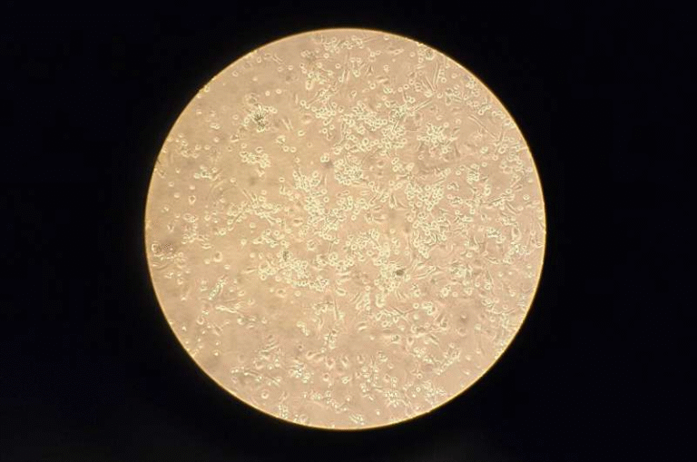 New Research Shows the PTPN22 Gene Doesn’t Actually Boost Interferon Production