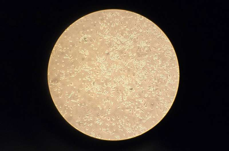 New Research Shows the PTPN22 Gene Doesn’t Actually Boost Interferon Production