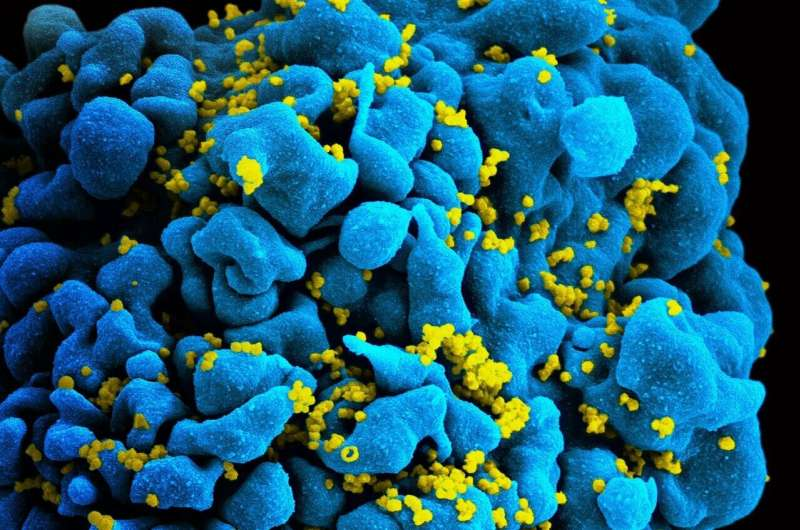 New Findings Reveal How Overactive Immune Cells Help HIV Persist Even Under Treatment